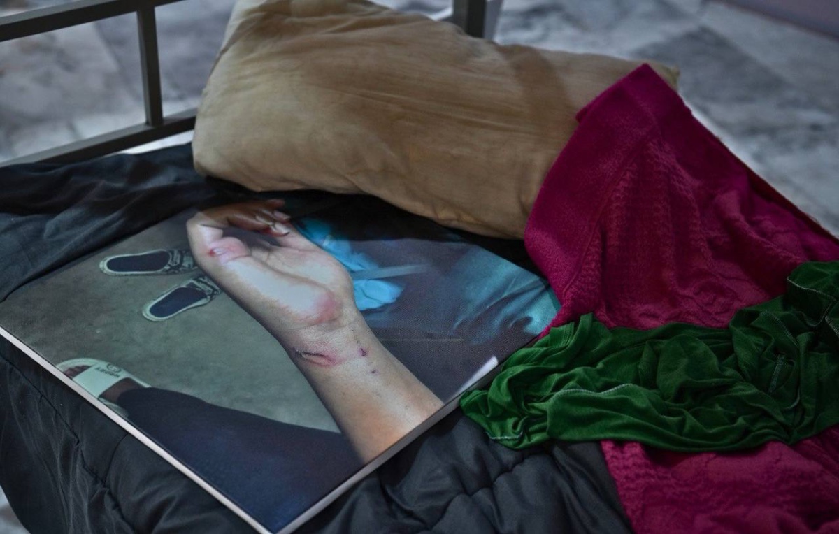 曼谷外国记者协会正在举办一场展览，讲述缅甸妙瓦底诈骗园区受害者遭遇的虐待